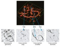 TOPOGRAFÍA DE RAYOS X